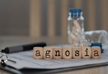 Agnozi Nedir?