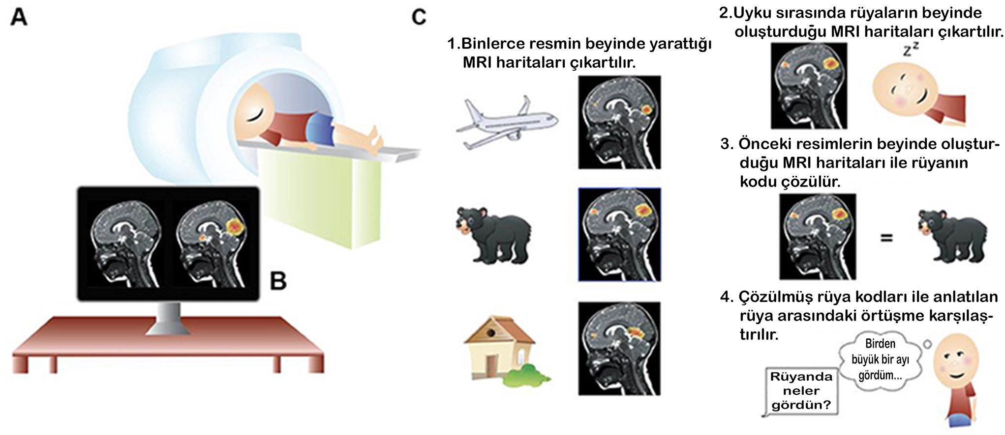 Rüyalar / MRI Görüntüleri / Rüyaların Kodları ve Çözümleri