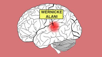 Wernicke's Area and Language
