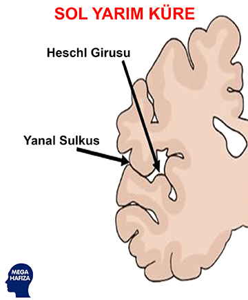 heschl girusu - heschl's gyrus